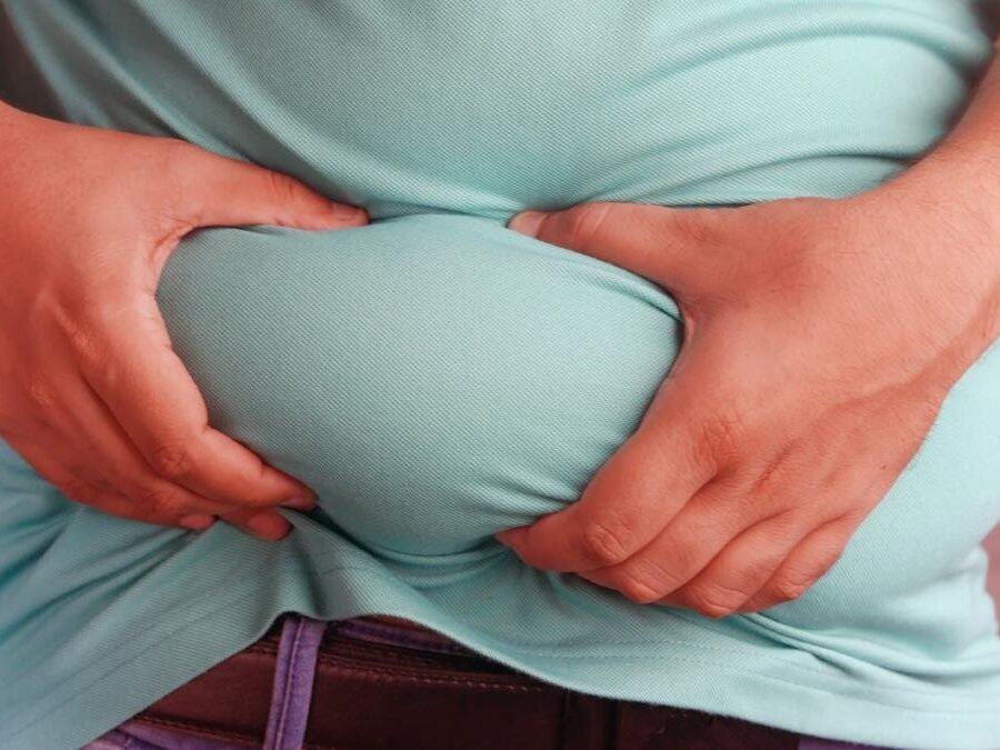Obesidade: entenda as causas dessa doença crônica e multifatorial