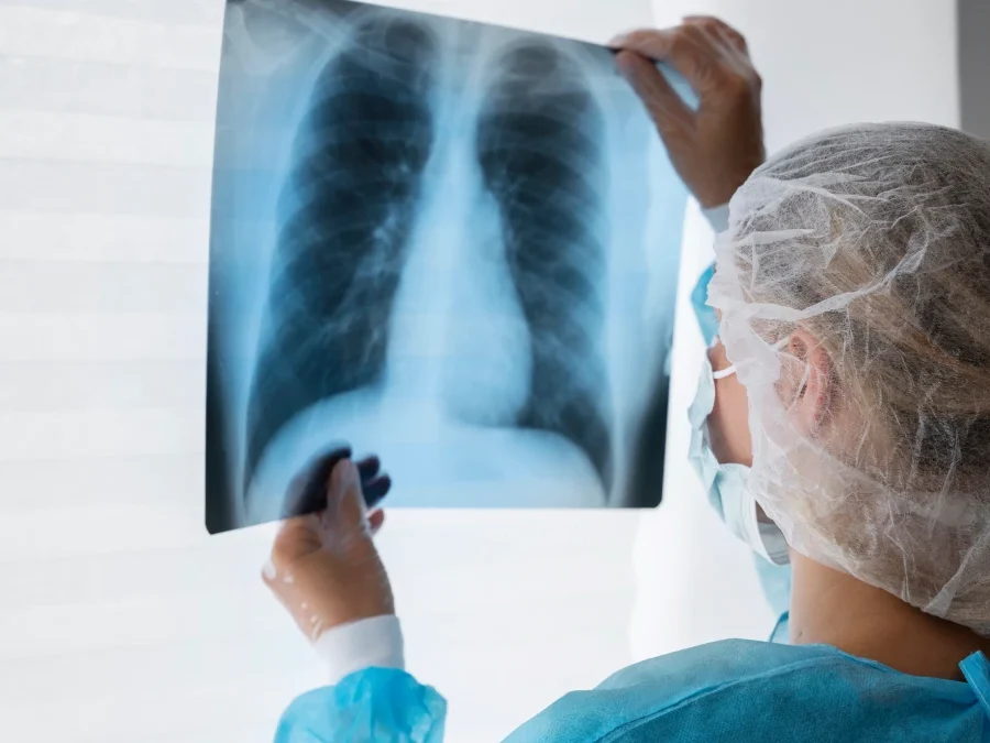 Enfisema pulmonar: o que é, sintomas, causas e tratamento